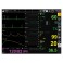 Moniteur GIMA BM3 - ECG + SPO2 + PNI + RESP + TEMP