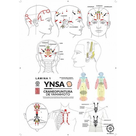 Yamamoto's YINSA Cranio-puncture Lam1