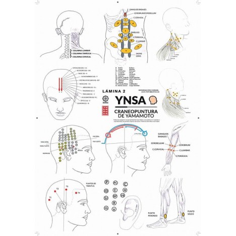 Yamamoto Lam2 YINSA Cranio-puncture Lam2