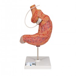 Modèle d'anneau gastrique - 3B Smart Anatomy