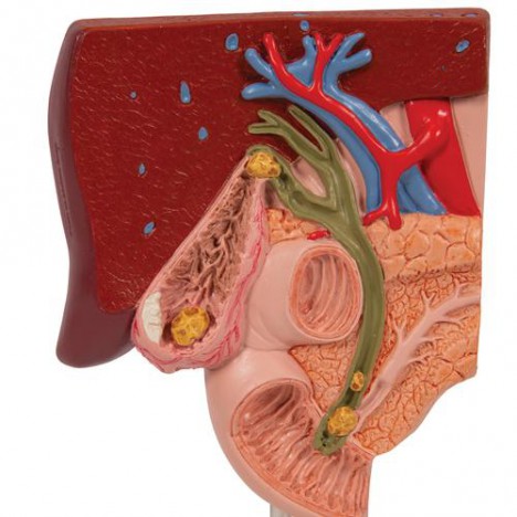 Modèle de calcul biliaire - 3B Smart Anatomy