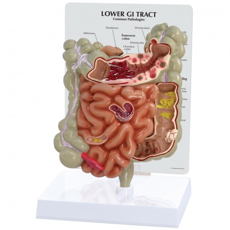 Modèle du tractus gastro-intestinal