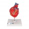 Coeur classique avec pontage, 2 pièces - 3B Smart Anatomy