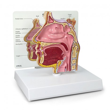 Coupe transversale du sinus nasal