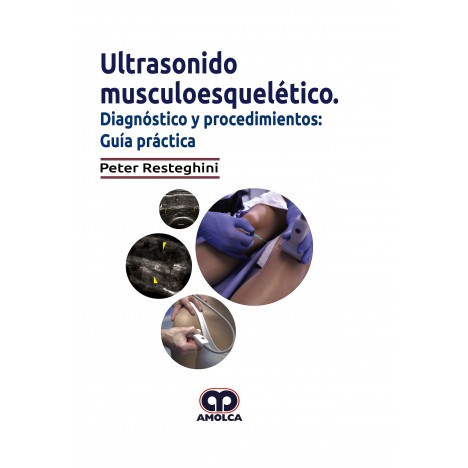 Échographie musculo-squelettique. Diagnostic et procédures : un guide pratique