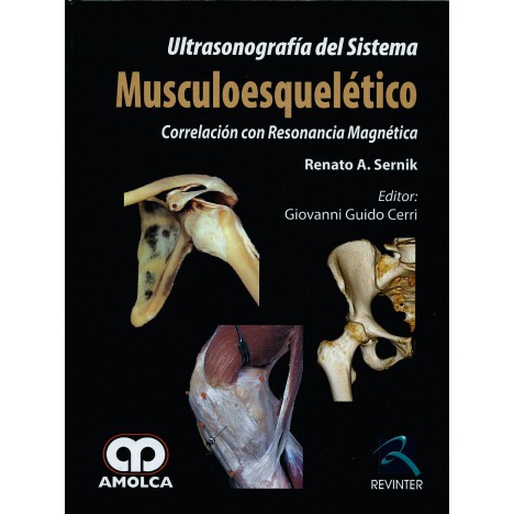 Ultrasonografía del Sistema Musculoesquelético. Correlación con Resonancia Magnética