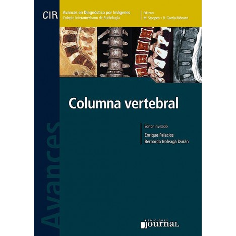 Avances en Diagnóstico por Imágenes 10: Columna Vertebral